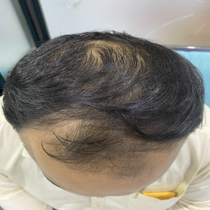 After