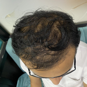Before