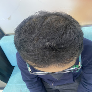 After