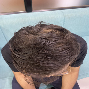 After