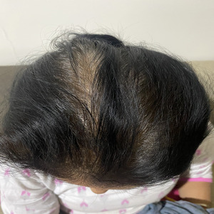 After