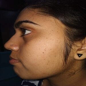 Before